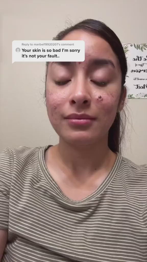 Snail 96 Mucin Power Essence 100 Ml (Pack of 2)